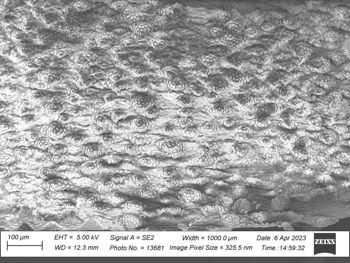 Media type: image;   Invertebrate Zoology 32029 Description: SEM image of specimen.;  Aspect: ventral